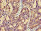 Mitochondrial Calcium Uptake 2 antibody, LS-C674645, Lifespan Biosciences, Immunohistochemistry paraffin image 