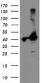 TBC1 Domain Family Member 21 antibody, CF503671, Origene, Western Blot image 