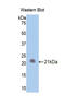 LIF Receptor Subunit Alpha antibody, LS-C299779, Lifespan Biosciences, Western Blot image 