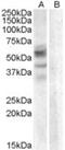 Arylsulfatase D antibody, NBP1-20886, Novus Biologicals, Western Blot image 