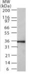 Nucleolar Protein Interacting With The FHA Domain Of MKI67 antibody, GTX13880, GeneTex, Western Blot image 