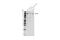 TBC1 Domain Family Member 1 antibody, 66433S, Cell Signaling Technology, Western Blot image 