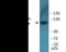 ATP Citrate Lyase antibody, EKC2144, Boster Biological Technology, Western Blot image 