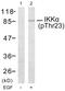 Component Of Inhibitor Of Nuclear Factor Kappa B Kinase Complex antibody, ab38515, Abcam, Western Blot image 