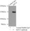 Kinesin Family Member 15 antibody, FNab04551, FineTest, Immunoprecipitation image 