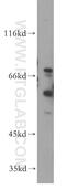 Histamine Receptor H2 antibody, 13414-1-AP, Proteintech Group, Western Blot image 