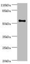 Thyroid Hormone Receptor Beta antibody, A50532-100, Epigentek, Western Blot image 