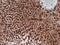 Coagulation factor VIII antibody, ab78852, Abcam, Immunohistochemistry paraffin image 