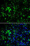 Potassium Voltage-Gated Channel Subfamily A Member 2 antibody, MBS9125948, MyBioSource, Immunofluorescence image 