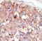 Protein Tyrosine Kinase 6 antibody, LS-C99386, Lifespan Biosciences, Immunohistochemistry frozen image 