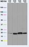 NADH:Ubiquinone Oxidoreductase Subunit S4 antibody, ab87399, Abcam, Western Blot image 