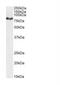 Carnitine Palmitoyltransferase 1A antibody, NB100-53791, Novus Biologicals, Western Blot image 