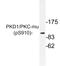 Serine/threonine-protein kinase D1 antibody, LS-C291518, Lifespan Biosciences, Western Blot image 