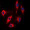 Cyclin Dependent Kinase Inhibitor 1B antibody, orb213715, Biorbyt, Immunofluorescence image 