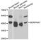 Serpin Family A Member 7 antibody, orb373367, Biorbyt, Western Blot image 