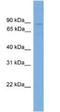 Glutaminyl-TRNA Synthetase antibody, NBP1-79632, Novus Biologicals, Western Blot image 