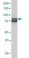 Metastasis Associated 1 antibody, H00009112-M02, Novus Biologicals, Western Blot image 