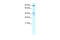 Zinc Finger CCCH-Type Containing 7B antibody, 27-617, ProSci, Enzyme Linked Immunosorbent Assay image 