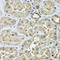 Polypeptide N-Acetylgalactosaminyltransferase 2 antibody, 22-548, ProSci, Immunohistochemistry frozen image 