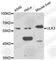 Unc-51 Like Kinase 3 antibody, A7587, ABclonal Technology, Western Blot image 