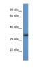 Acyl-CoA Binding Domain Containing 6 antibody, NBP1-79817, Novus Biologicals, Western Blot image 