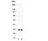 Glutathione Peroxidase 2 antibody, R30910, NSJ Bioreagents, Western Blot image 