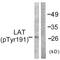 Linker For Activation Of T Cells antibody, LS-C199190, Lifespan Biosciences, Western Blot image 