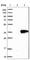 Tropomyosin alpha-1 chain antibody, HPA000261, Atlas Antibodies, Western Blot image 