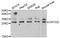 Gamma-crystallin D antibody, STJ28307, St John