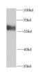 Karyopherin Subunit Alpha 6 antibody, FNab04638, FineTest, Western Blot image 