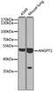 Angiopoietin 1 antibody, 23-247, ProSci, Western Blot image 