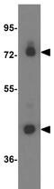 Acyl-CoA Synthetase Long Chain Family Member 1 antibody, GTX17180, GeneTex, Western Blot image 