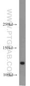 Amyloid Beta Precursor Protein Binding Family A Member 2 antibody, 19781-1-AP, Proteintech Group, Western Blot image 