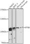 Intraflagellar Transport 88 antibody, LS-C748117, Lifespan Biosciences, Western Blot image 