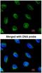 Lysine Acetyltransferase 2B antibody, NBP1-31192, Novus Biologicals, Immunocytochemistry image 