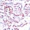 Activating Transcription Factor 2 antibody, 79-116, ProSci, Immunohistochemistry paraffin image 