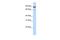 Homeodomain Interacting Protein Kinase 4 antibody, PA5-43886, Invitrogen Antibodies, Western Blot image 