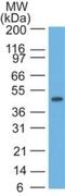 Keratin-17 antibody, NBP2-29421, Novus Biologicals, Western Blot image 