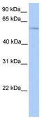 PLAG1 Zinc Finger antibody, TA335810, Origene, Western Blot image 