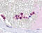 Interferon Regulatory Factor 4 antibody, 51-476, ProSci, Immunohistochemistry paraffin image 