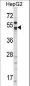 G250 antibody, LS-C100337, Lifespan Biosciences, Western Blot image 