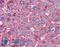 Apolipoprotein B antibody, LS-B2592, Lifespan Biosciences, Immunohistochemistry paraffin image 