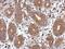 Four And A Half LIM Domains 2 antibody, PA5-28643, Invitrogen Antibodies, Immunohistochemistry paraffin image 