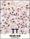 Histone Deacetylase 11 antibody, 55-646, ProSci, Immunohistochemistry paraffin image 