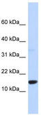 TPD52 Like 3 antibody, TA344226, Origene, Western Blot image 