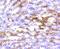 Major Histocompatibility Complex, Class II, DR Alpha antibody, NBP2-67610, Novus Biologicals, Immunohistochemistry paraffin image 