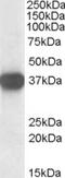 Nucleophosmin 1 antibody, TA303008, Origene, Western Blot image 