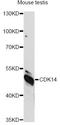 Cyclin Dependent Kinase 14 antibody, LS-C749966, Lifespan Biosciences, Western Blot image 