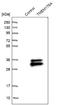 Transmembrane Protein 176A antibody, NBP1-83283, Novus Biologicals, Western Blot image 