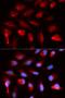 Peroxisome Proliferator Activated Receptor Delta antibody, LS-C334195, Lifespan Biosciences, Immunofluorescence image 